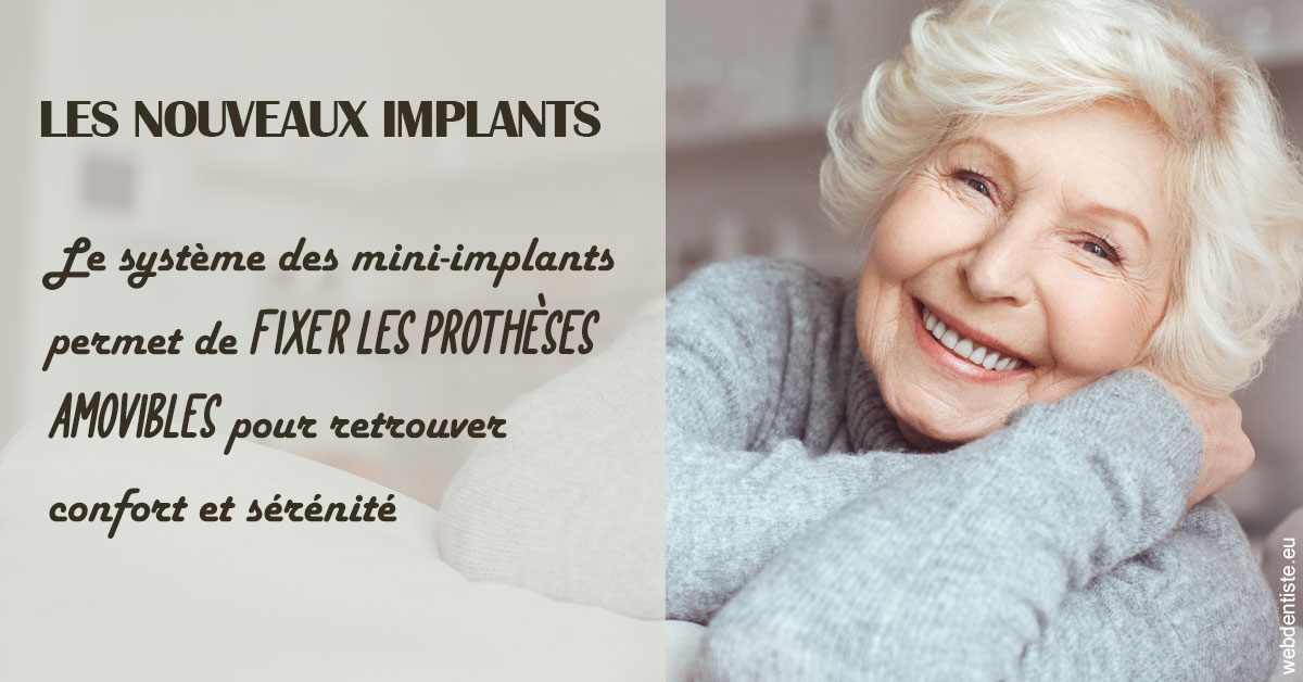 https://selarl-cabinet-docteur-bertrand.chirurgiens-dentistes.fr/Les nouveaux implants 1