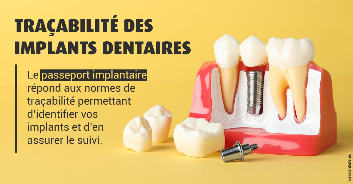 https://selarl-cabinet-docteur-bertrand.chirurgiens-dentistes.fr/T2 2023 - Traçabilité des implants 2