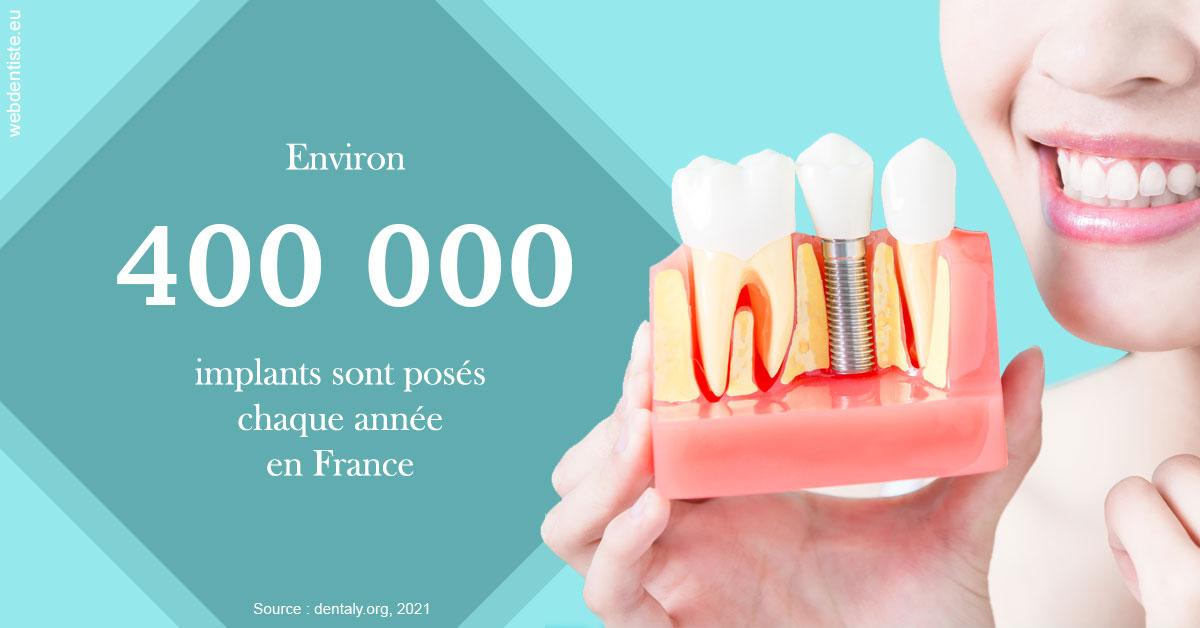 https://selarl-cabinet-docteur-bertrand.chirurgiens-dentistes.fr/Pose d'implants en France 2