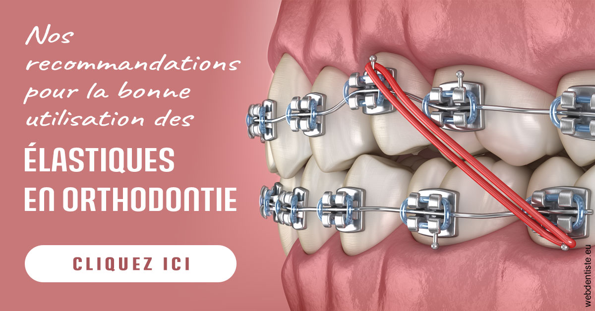 https://selarl-cabinet-docteur-bertrand.chirurgiens-dentistes.fr/Elastiques orthodontie 2